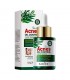 Serum Facial Acnes Oil Control Sadoer 30ML